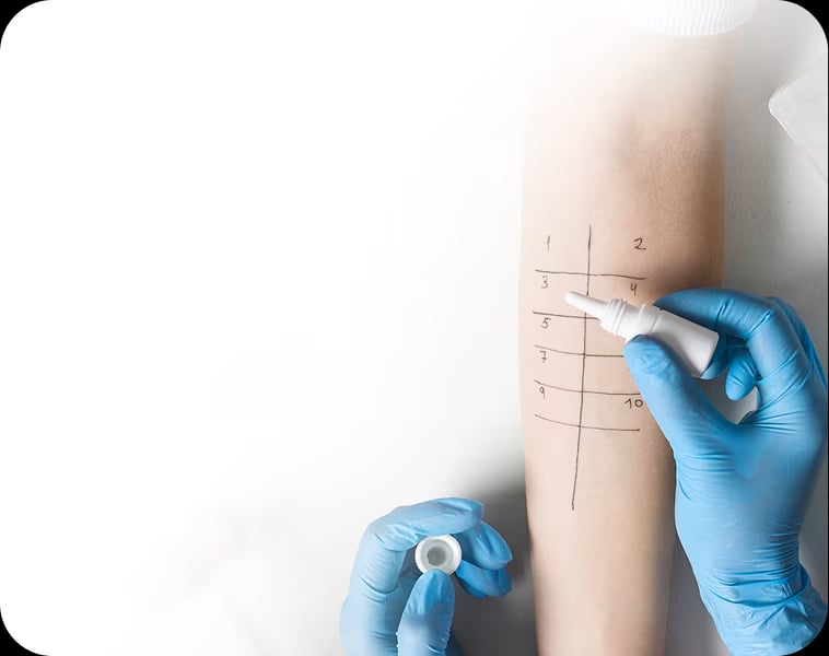 W ramach pakietu wykonasz testy alergiczne skórne i płatkowe – pozwalają one wykryć uczulenia pokarmowe, wziewne i kontaktowe. Jeśli zostanie stwierdzona alergia, możesz skorzystać z odczulania (immunoterapii).